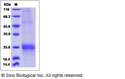 Sino Biological Human SLC27A4 / FATP4 Protein (His Tag) 100ug, Quantity: