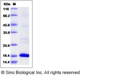 Sino Biological Recombinant Human RFK Protein (His Tag), Quantity: Each