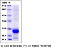 Sino Biological Recombinant Human GPHA2 Protein (His Tag), Quantity: Each