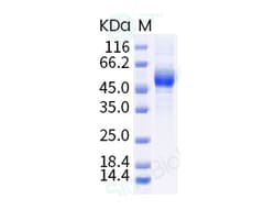 Sino Biological Recombinant Human NKG2A Protein (hFc Tag), HPLC-verified,