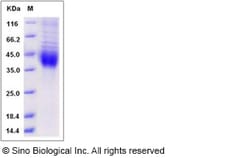 Sino Biological Recombinant Human ASGR2 Protein (His Tag), HPLC-verified
