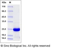 Sino Biological Recombinant Human ABHD14B Protein (His Tag), Quantity: