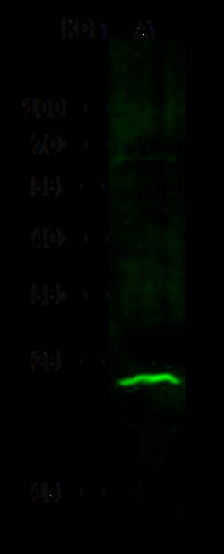 Sino Biological ABHD14B Antibody, Rabbit MAb 100µL, Quantity: Each of 1