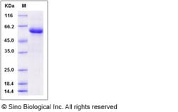 Sino Biological Recombinant Human BPIFA2 Protein (hFc Tag), Quantity: Each