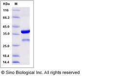 Sino Biological Recombinant Human BLOC1S2 Protein (GST Tag), Quantity: