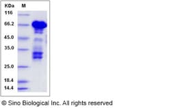 Sino Biological Human PARVA / Actopaxin Protein (GST Tag) 100ug, Quantity: