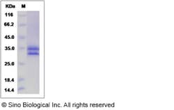 Sino Biological Recombinant Human Factor H-related 2/CFHR2 Protein (His