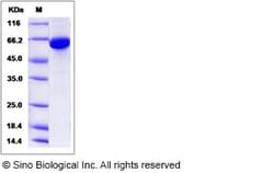 Sino Biological Recombinant Human SAE1 Protein (His & GST Tag), Quantity: