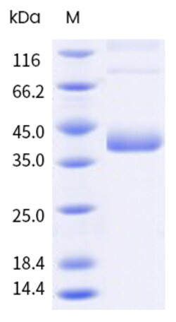 Sino Biological&nbsp;Recombinant Human SAE1 Protein, Biotinylated 100