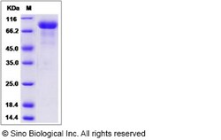 Sino Biological Recombinant Human SLITRK6 Protein (His Tag), HPLC-verified,