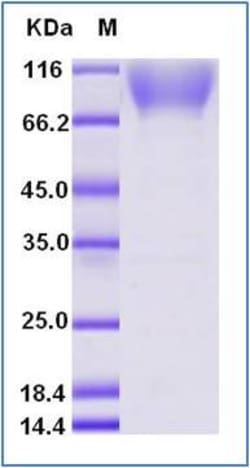 Sino Biological Human EphA2 Protein (His & AVI Tag), Biotinylated 100ug,