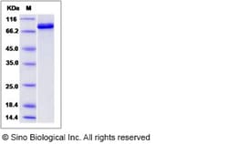 Sino Biological Human IHPK1 Protein (His & GST Tag) 50ug, Quantity: Each