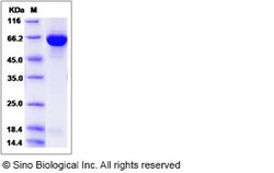 Sino Biological Recombinant Human GBP2 Protein (His Tag), Quantity: Each