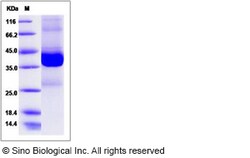 Sino Biological Human EIF-5A / EIF5 Protein (GST Tag) 100ug, Quantity: