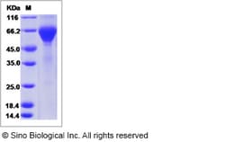 Sino Biological Recombinant Human GLP1R Protein (hFc Tag), HPLC-verified,