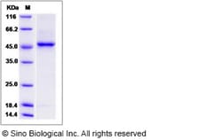 Sino Biological Recombinant Human B3GNT6 Protein (aa 44-384, His Tag),