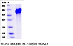 Sino Biological Recombinant Human LRP11 Protein (His Tag), HPLC-verified,