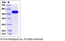 Sino Biological Recombinant Human B3GALTL Protein (His Tag), Quantity: