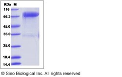 Sino Biological Recombinant Human ROR1 Protein (hFc Tag), Quantity: Each