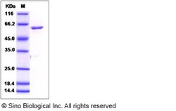 Sino Biological Recombinant Human ROR1 Protein (aa 453-783, His & GST Tag),