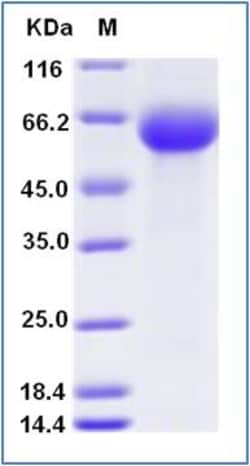 Sino Biological Recombinant Human ROR1 Protein (ECD, His & AVI Tag), Biotinylated,