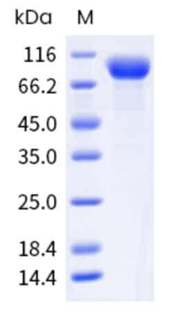 Sino Biological Human ROR1 Protein 100ug (Sino Biological), Quantity: Each