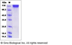Sino Biological Human SEZ6L2 / PSK-1 Protein (His Tag) 100ug, Quantity: