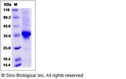 Sino Biological Recombinant Human PLAC9 Protein (mFc Tag), Quantity: Each