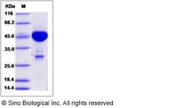 Sino Biological Human MOBKL1A / MOB1B Protein (GST Tag) 100ug, Quantity: