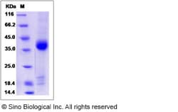 Sino Biological Recombinant Human RPRD1B Protein (His Tag), Quantity: Each