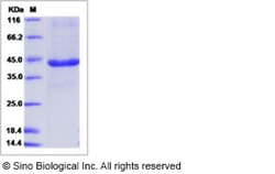 Sino Biological Recombinant Human PEX11A Protein (mFc Tag), Quantity: Each
