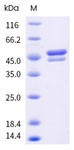Sino Biological&nbsp;Recombinant Human DLST Protein (His Tag), HPLC-verified 100 µg