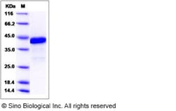 Sino Biological Human HBP1 Protein (GST Tag) 100ug, Quantity: Each of 1