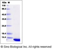 Sino Biological Recombinant Human PDRG1 Protein (His Tag), Quantity: Each