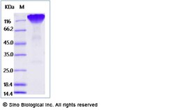 Sino Biological Human CD45 Protein (ECD, His Tag) 50ug, Quantity: Each