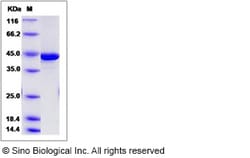 Sino Biological Recombinant Human IVD Protein (aa 30-423, His Tag), Quantity: