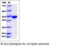 Sino Biological Recombinant Human CAPG Protein, Quantity: Each of 1