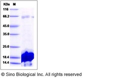 Sino Biological Recombinant Human Iba1 Protein (His Tag), Quantity: Each