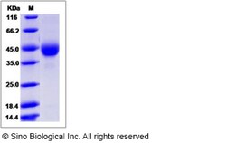 Sino Biological Human TSPAN31 Protein (Fc Tag) 100ug, Quantity: Each of
