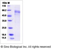 Sino Biological Human ARHI / DIRAS3 Protein (Fc Tag) 100ug, Quantity: Each