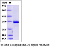 Sino Biological Human Esterase D / ESD Protein (His Tag) 100ug, Quantity: