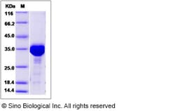 Sino Biological Recombinant Human CKAP1/TBCB Protein (His Tag), Quantity: