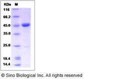 Sino Biological Recombinant Human ENO3 Protein (His Tag), Quantity: Each