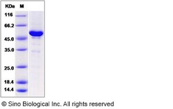 Sino Biological Human NAA10 / ARD1A Protein (His & GST Tag) 100ug, Quantity: