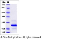 Sino Biological Recombinant Human CARHSP1 Protein (His Tag), Quantity: