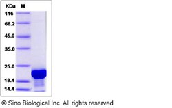Sino Biological Recombinant Human TPPP3 Protein (His Tag), Quantity: Each