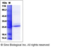 Sino Biological Recombinant Human Cytoglobin Protein (His Tag), Quantity: