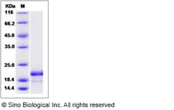 Sino Biological Recombinant Human ASF1B Protein (His Tag), Quantity: Each