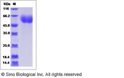 Sino Biological Recombinant Human IL1RL2 Protein (His Tag) 1, Quantity: