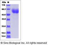 Sino Biological Human IL1RL2 / IL-1Rrp2 Protein (His Tag) 100ug, Quantity: